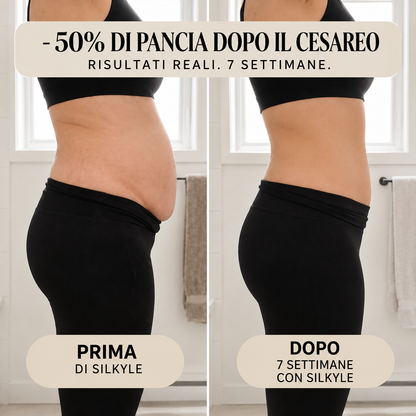 Slip Post-Partum Silkyle™ — Compressione 360°